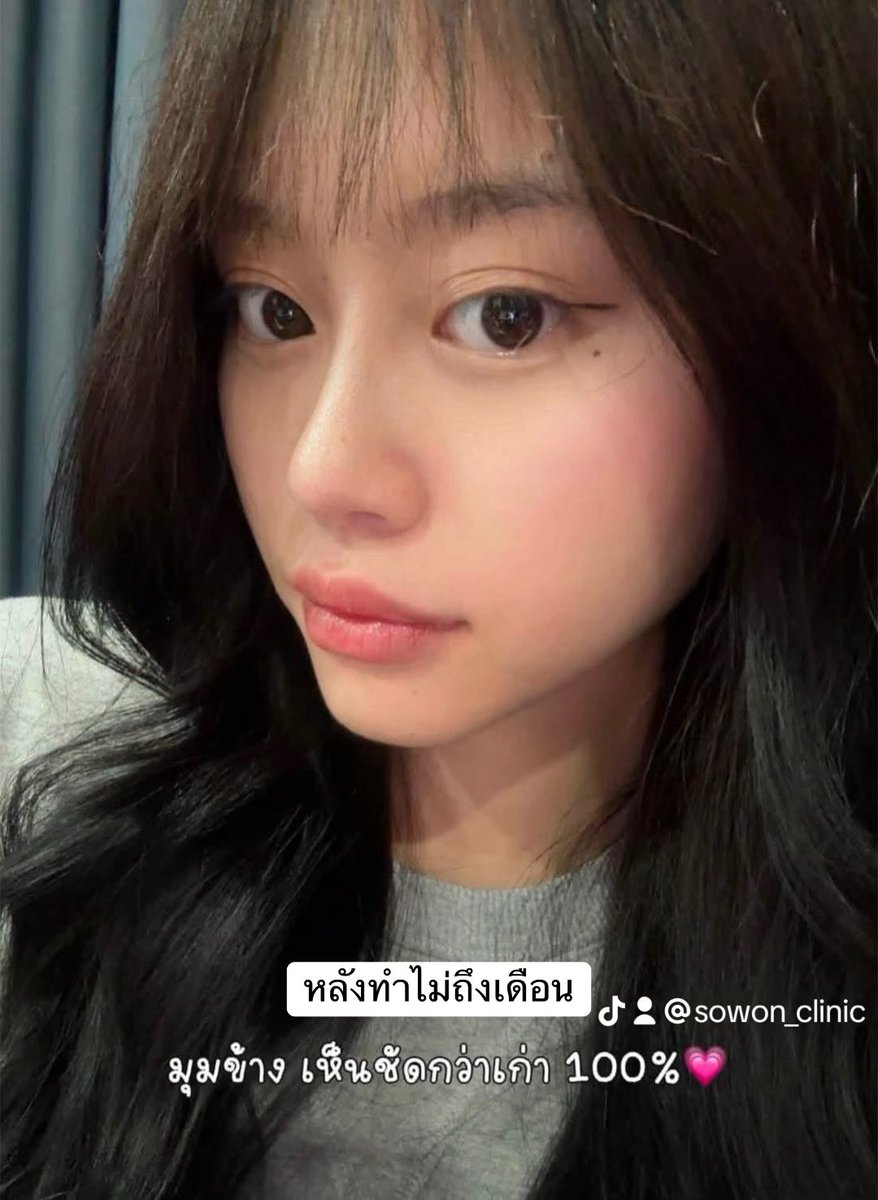 SowonClinic's tweet photo. เมื่อก่อนยังไม่เริ่ด ตอนนี้เป็นลูกสาวโซวอนแล้วสวยหวานมาก 💞 ตรงปกไม่ให้ภาพเล่าเรื่อง #sowonclinic https://t.co/JOAIw0BKSZ
