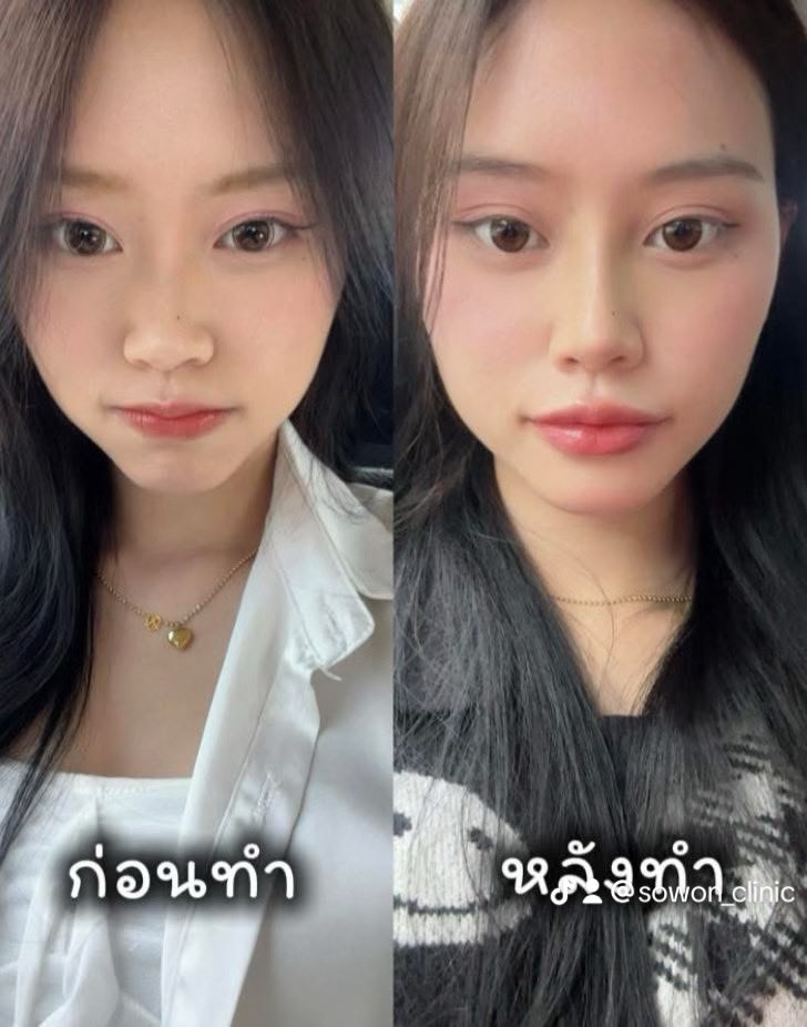 SowonClinic's tweet photo. https://t.co/nL3I2bpvaG