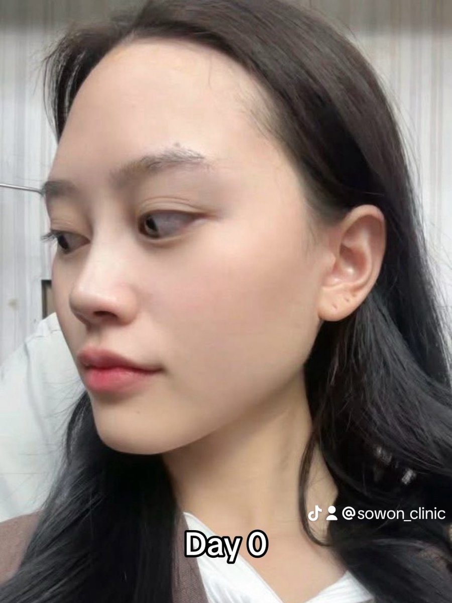 SowonClinic's tweet photo. https://t.co/nL3I2bpvaG