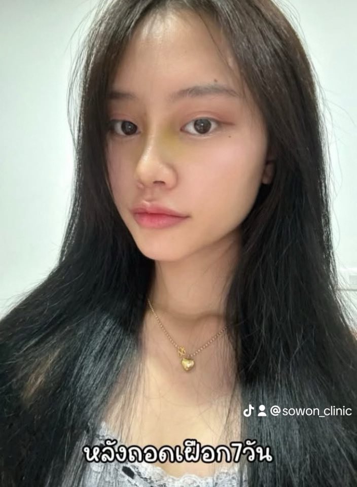 SowonClinic's tweet photo. https://t.co/nL3I2bpvaG
