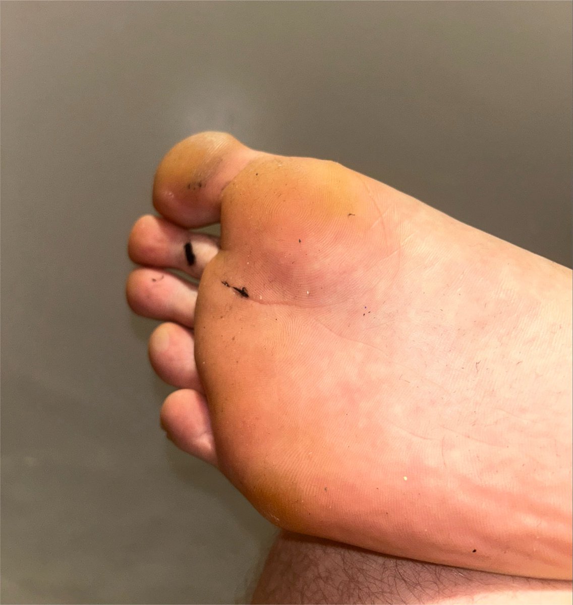 MasterOscarH's tweet photo. Sniff the stink out of my big cheesy teen soles freak I want to hear you inhale my scent 😏

Swallow all that lint too 

Findom young teen master scally dom foot slave feet stink lint https://t.co/SqDx5A5MU1
