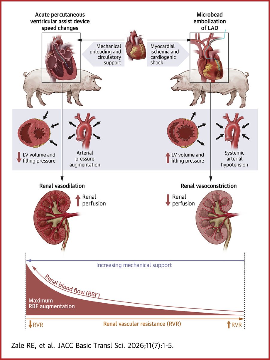 JACCJournals's tweet photo. Mortality from cardiogenic shock is significantly affected by concomitant renal failure. See how renal vascular tone affects whether MCS can augment renal perfusion &amp; the potential of pharmacologic therapies to optimize renal support. https://t.co/fPes4rNNVZ #JACCBTS https://t.co/5xJekbswuD