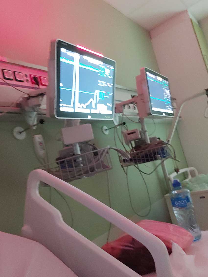 IQKoder's tweet photo. Preživeo sam infrakt, sad sam kod kuće i pripremam za operaciju krajem meseca. Srce mi je jako slabo, radi na svega 20%, sve tri glavne aterije su sužene od loših krvnih sudova izazavanim dijabetesom, iz pluća mi je izvađeno 6 litara vode. Srpski doktori su the best! 😇😇😇 https://t.co/J6nfpYVJCY