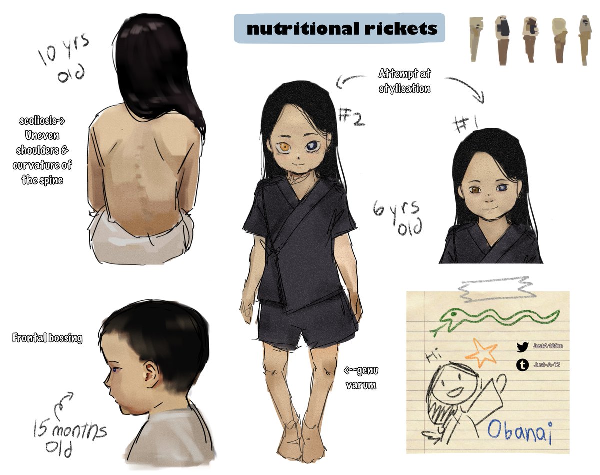 JustA120m's tweet photo. Rickets art study with child Obanai. Thank you to the person who gave critique last time! 
#kny #obanaiiguro https://t.co/sJjJXDFXb9