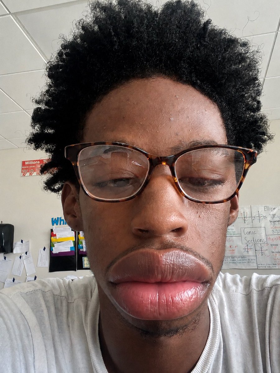 biglipmen's tweet photo. Str8 niggas with big lips rule my life https://t.co/AnB7MWH0L9
