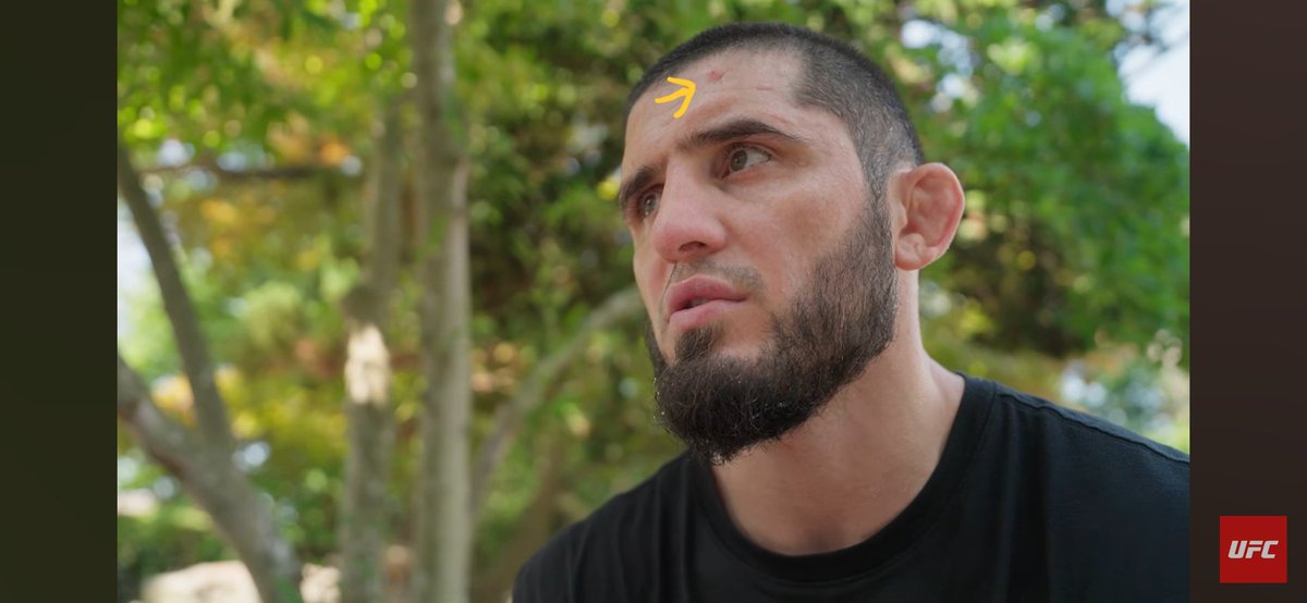 Combat_Xpert's tweet photo. Islam Makhachev have a staph infection? https://t.co/Io0DM5Tfj9