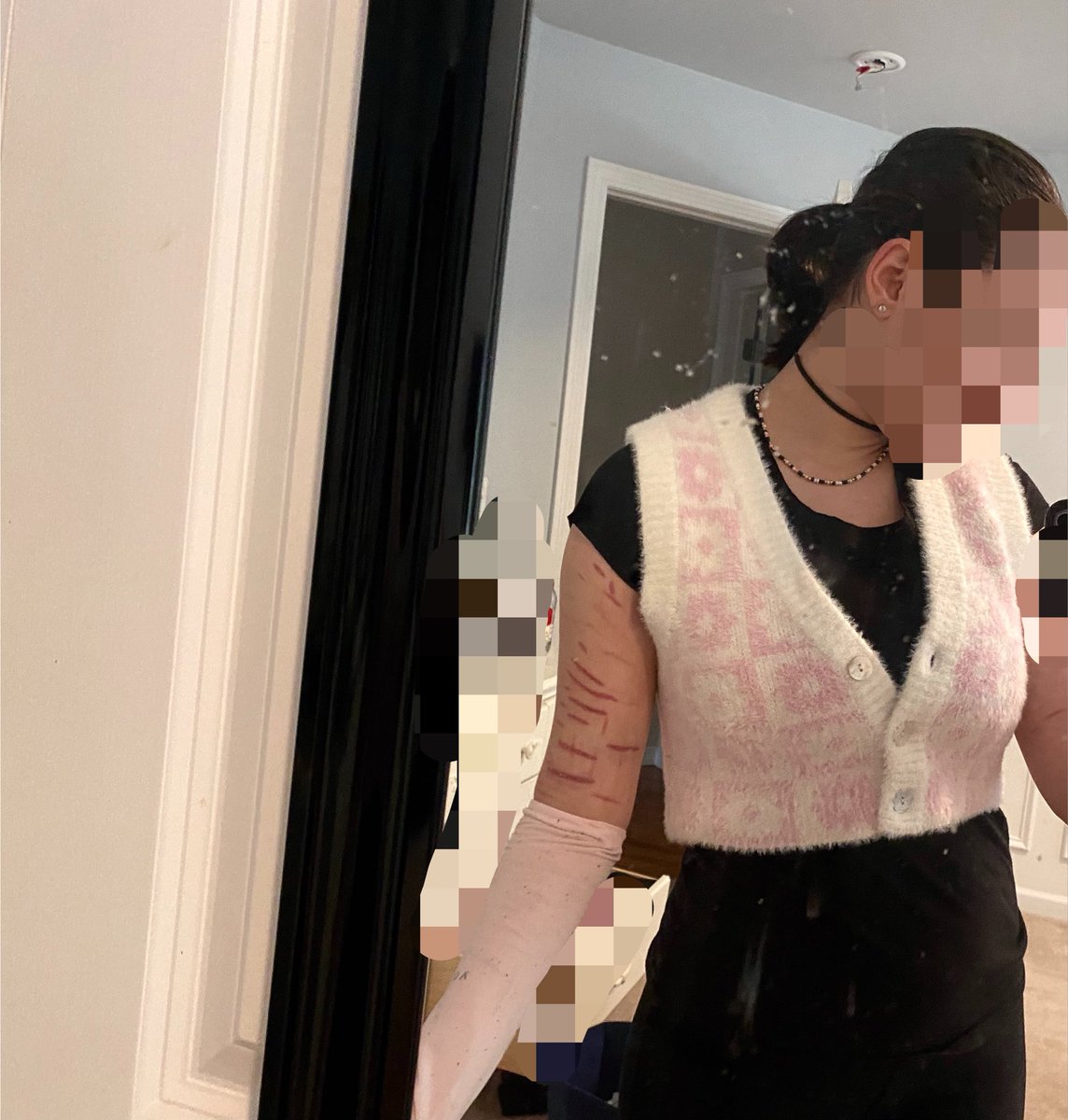 daybrrrr's tweet photo. sleeveless vs how i go out in public ….
fake arm it’s a mannequin with sfx makeup 
#988twt #slittwt #sfx https://t.co/FNbw6gPctN