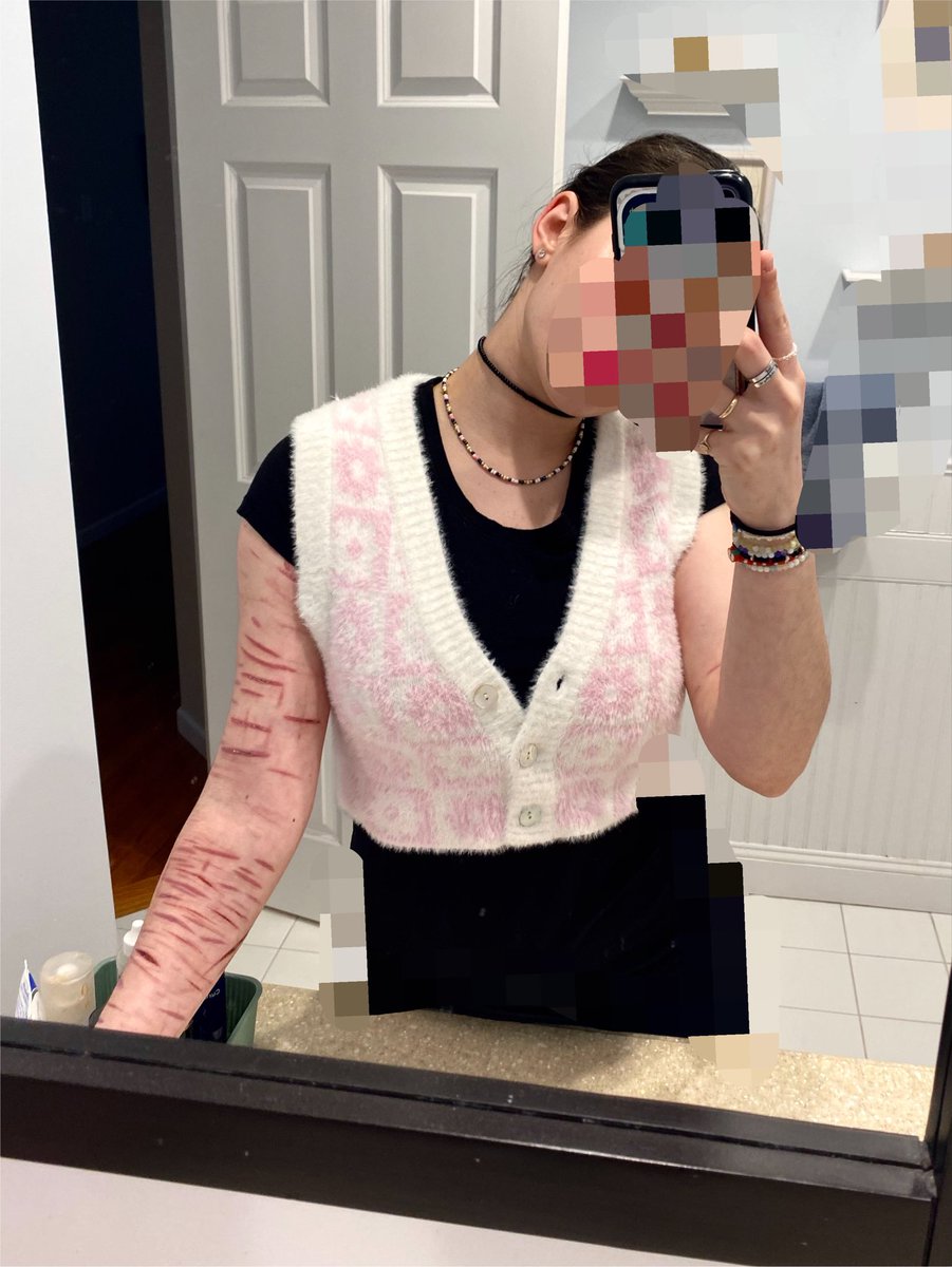 daybrrrr's tweet photo. sleeveless vs how i go out in public ….
fake arm it’s a mannequin with sfx makeup 
#988twt #slittwt #sfx https://t.co/FNbw6gPctN