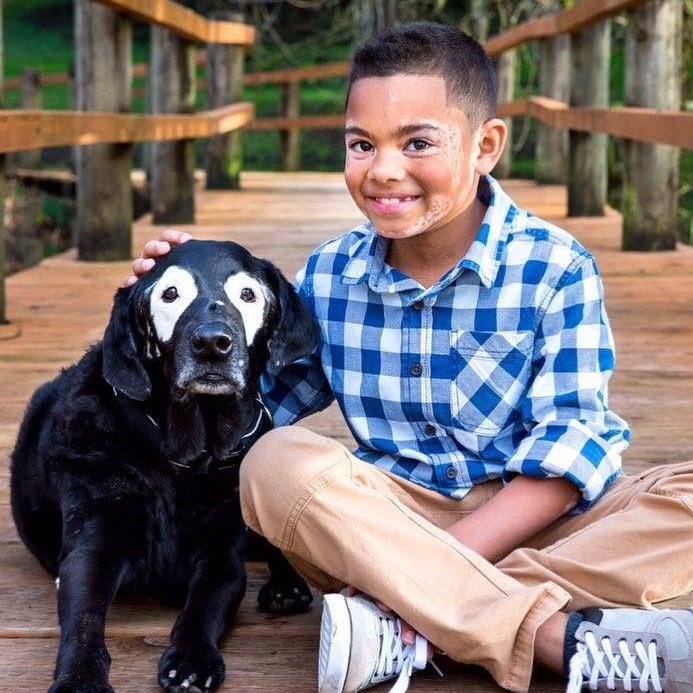 AcervoCharts's tweet photo. Menino de 8 anos supera a depressão após conhecer um cachorro com a mesma condição de pele que ele. https://t.co/nQ3D6HcLAb