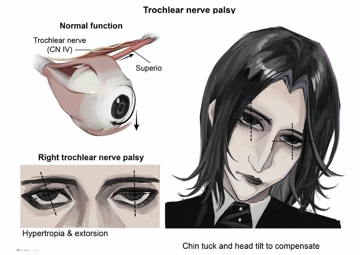 qzucer's tweet photo. #severussnape https://t.co/9gfRlM0tlI