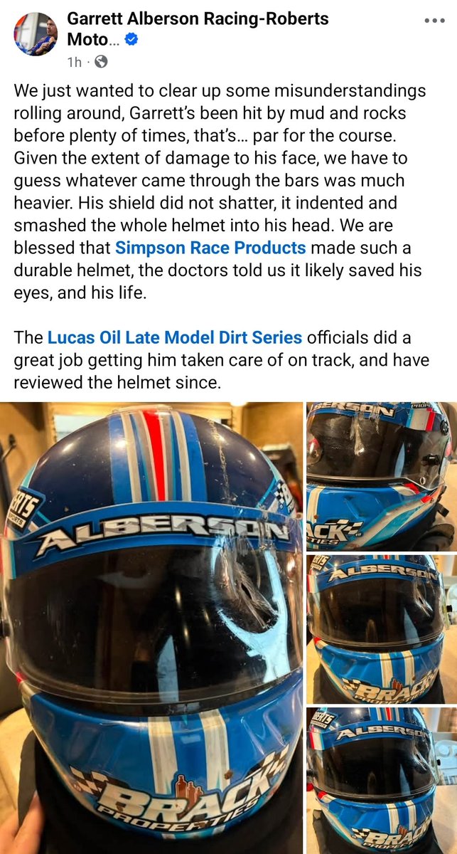 JFTrentRacing's tweet photo. Garrett Alberson and team share new details about what ended his North/South 100.

Garrett also told me: "Whatever it was didn't quite make it through the shield but impacted hard enough to essentially smash the shell/shield into my face/eye. So it was heavy whatever it was." https://t.co/gIV9KiPK1n