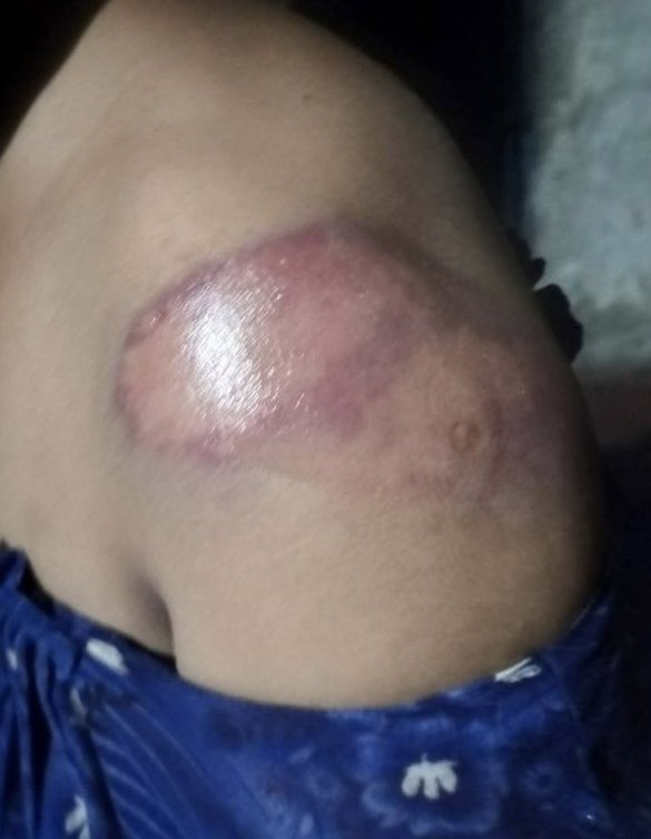 FarazPervaiz3's tweet photo. In Bangladesh 🇧🇩, Hindu women were brutally tortured by Awami League and BNP politicians who forced them to accept Islam. https://t.co/b8gQ6mOtoC