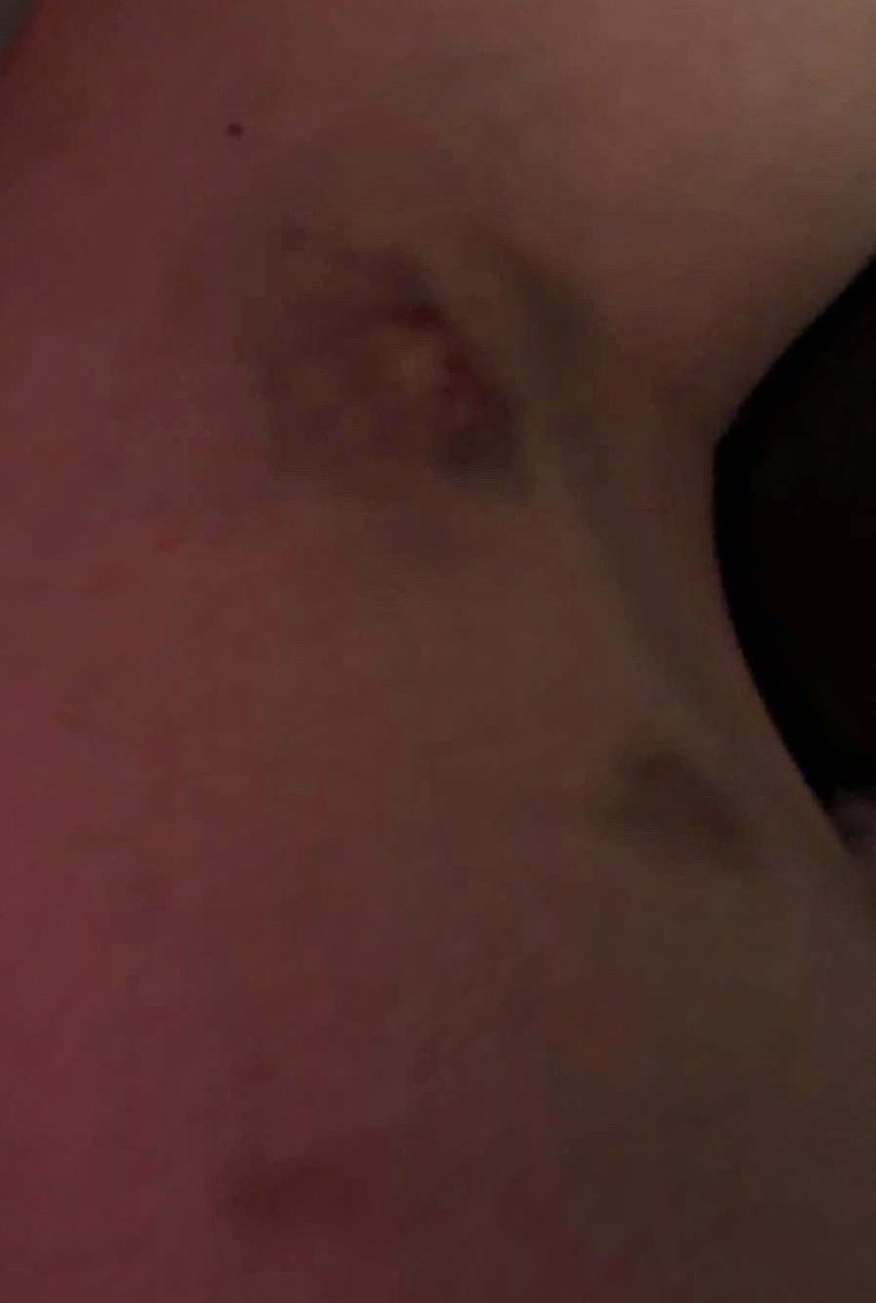 savingyoursoull's tweet photo. love language 😞 #bruises https://t.co/4dwD8bZw9E