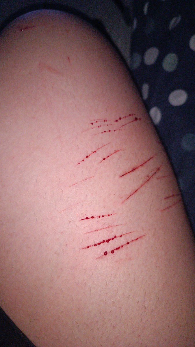 NamjoonsWife28's tweet photo. #shtwt #ai 
I hate myself 🫩
(Fake, SFX makeup for Helloween) https://t.co/z5sxVIRON5