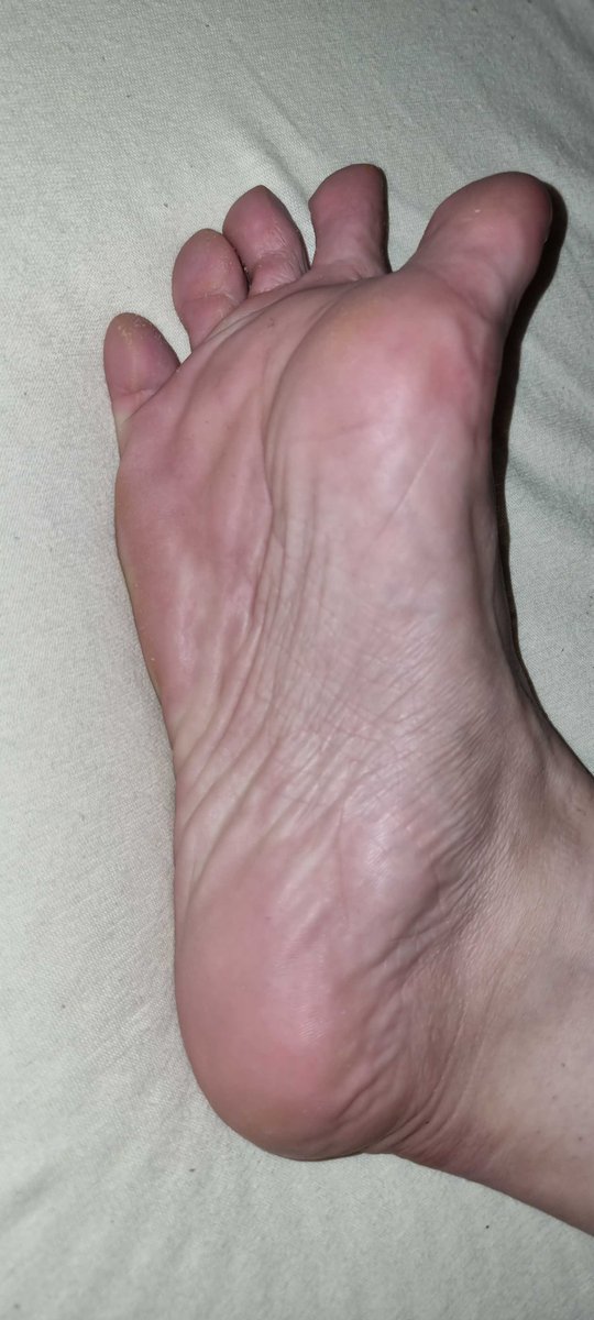 NV115fr's tweet photo. Quelle pointure font tes pieds ?
What shoe size are your feet?
#odorante 🤢#pieds  #feet https://t.co/serEnM3d8P
