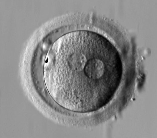 LauraPowellEsq's tweet photo. I understand why people struggle to see a human entitled to the right to life in the image on the left.

I don’t understand how anyone can fail to see a human entitled to the right to life in the image on the right. https://t.co/7F7MyTzKhO