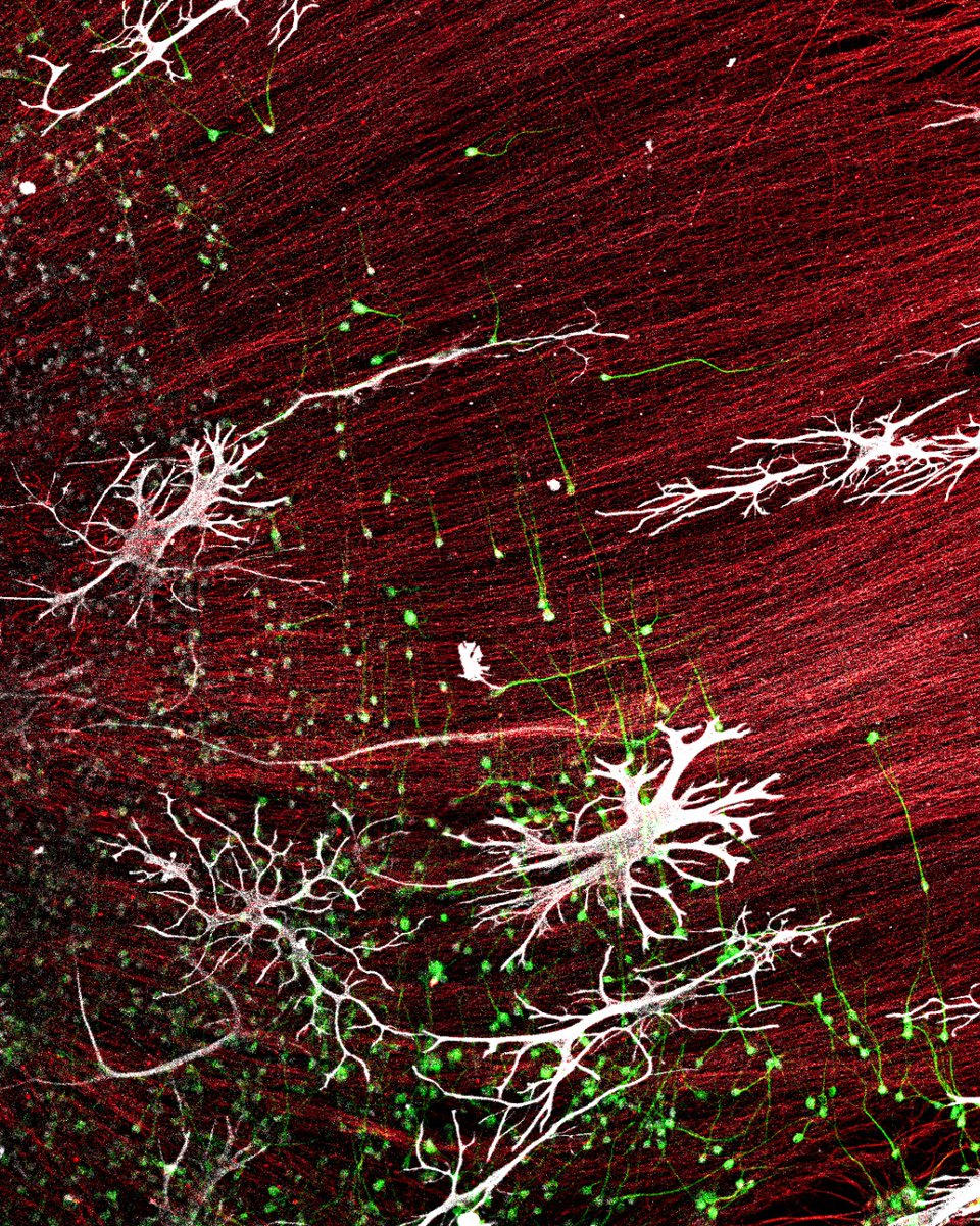 Proteintech's tweet photo. Entry Spotlight 🔬

A closer look at 5 incredible entries from our #Microscopy Image Competition.
Want to see your image featured next? 

The 2026 Microscopy Image Competition is open for entries until 5 Oct. 
Enter here: https://t.co/NcjN9vLxKa
#Immunofluorescence https://t.co/BmkW25yLwK