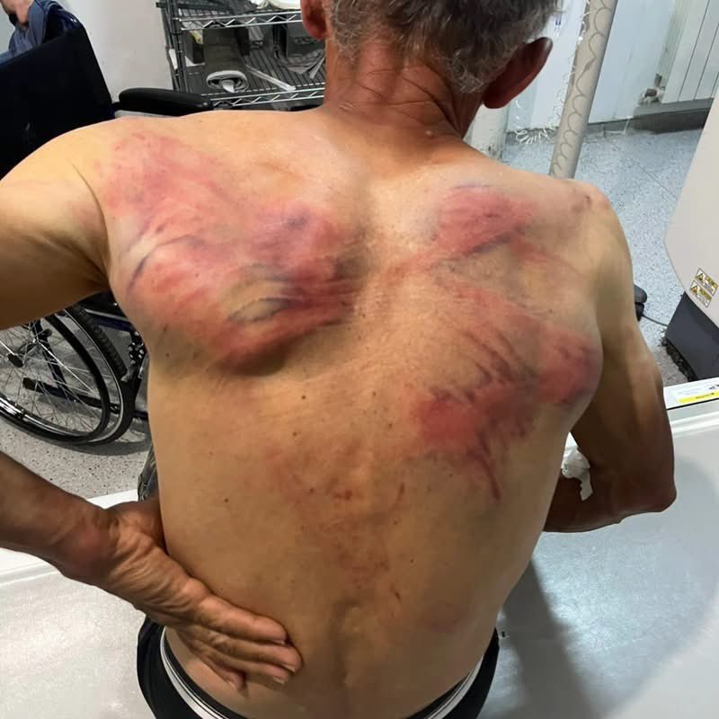 EparhijaKIM's tweet photo. Nenad Rašković, kojeg je danas brutalno pretukla Kosovska policija, izjavio je za Kosovo onlajn da su ga trojica izvukla iz njegove porodične kuće nakon čega su ga vezali za drvo i tukli ga tražeći da im da pušku koju, kako je rekao, nema.

https://t.co/7TESc863Sx https://t.co/x3qjlohJn0