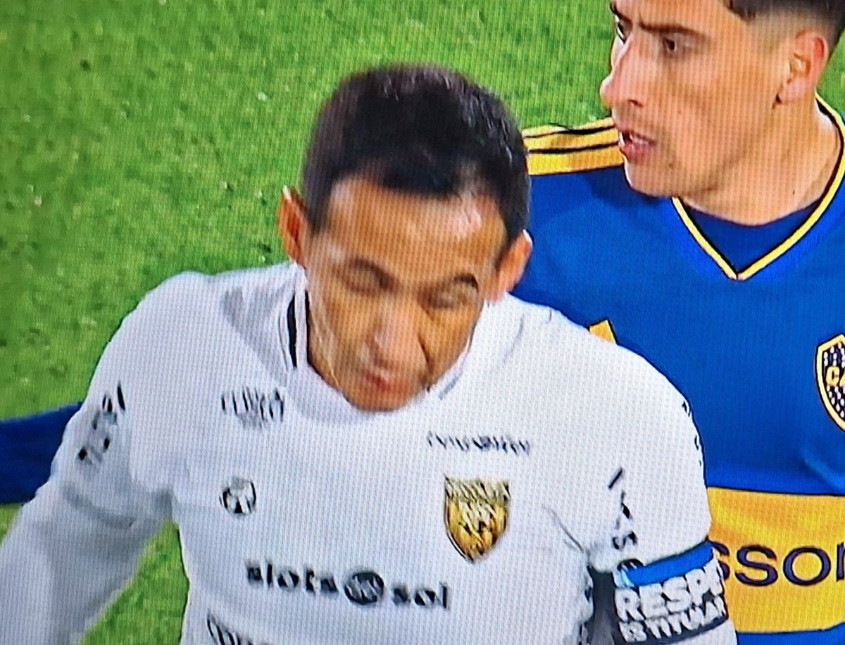 cabjedits's tweet photo. Cuantos años tiene este? https://t.co/OV0LlLfijf