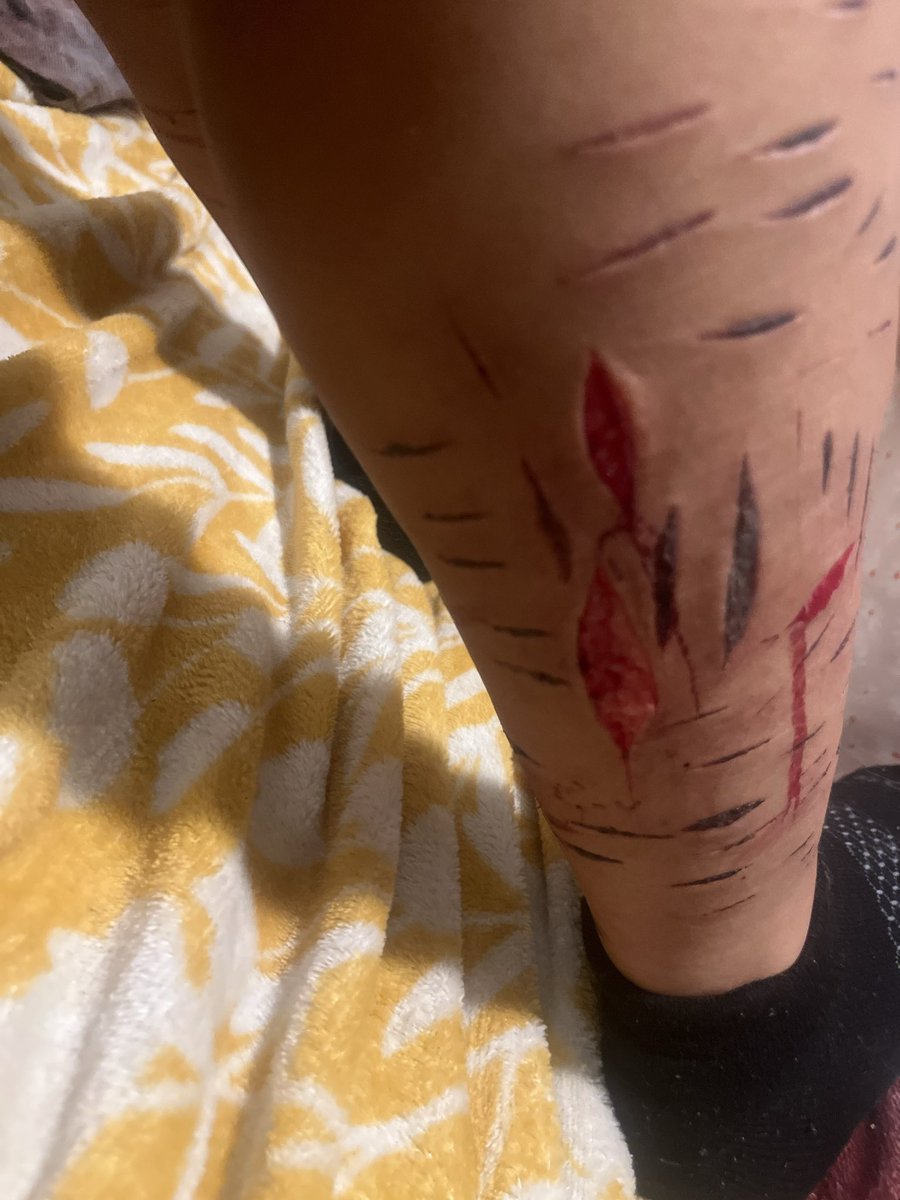valeries_wrld2's tweet photo. ok. twitter i promise this is fake sfx makeup. its ai generated https://t.co/YjOIjWGOY7