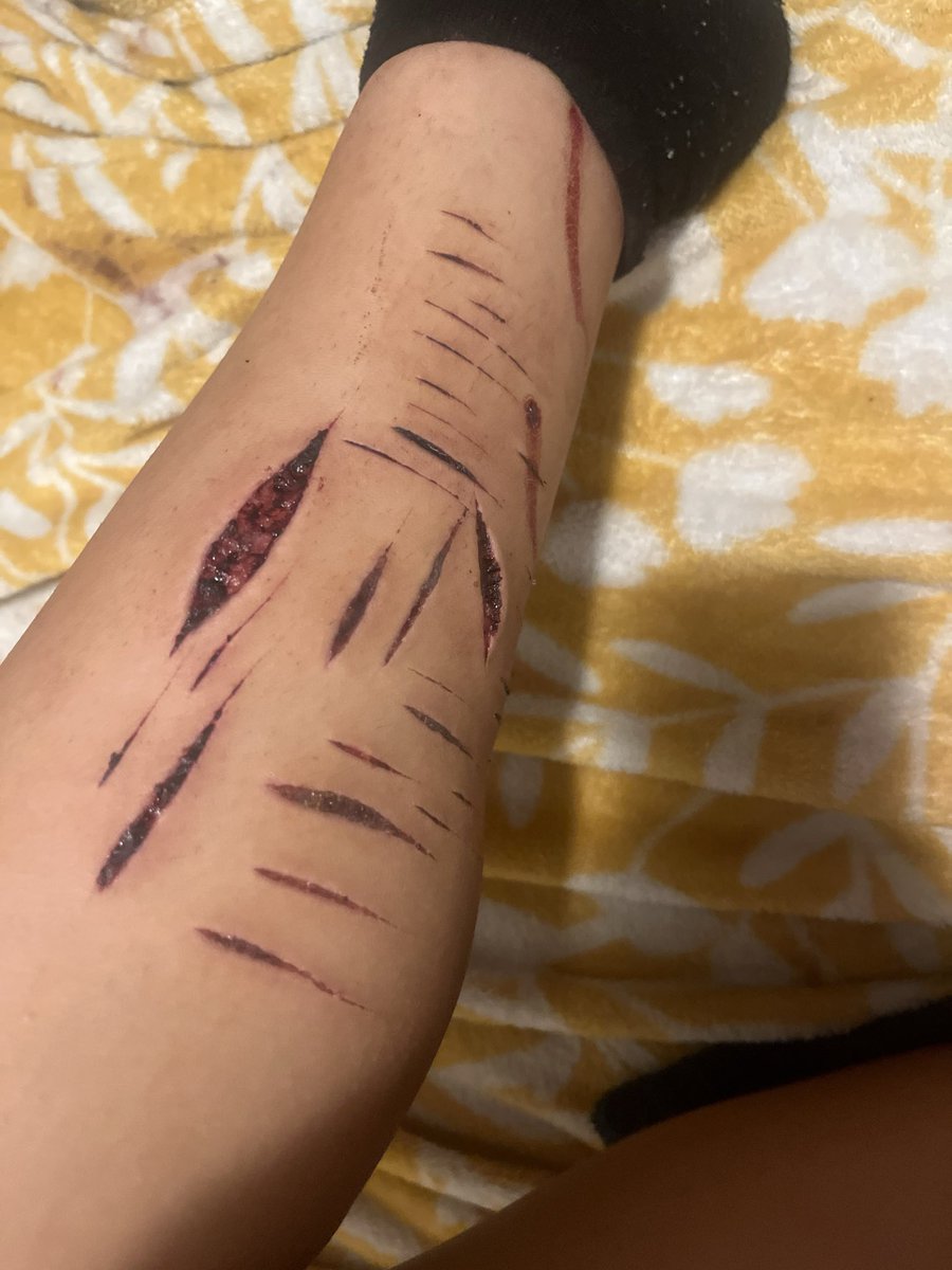 valeries_wrld2's tweet photo. ok. twitter i promise this is fake sfx makeup. its ai generated https://t.co/YjOIjWGOY7
