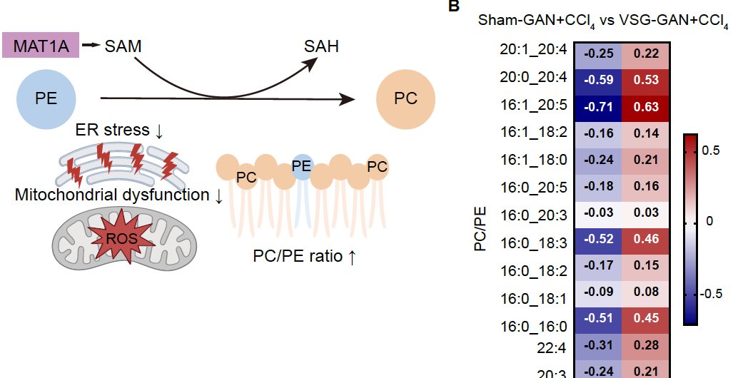 Brunorm84's tweet photo. Bariatric surgery resolves #MASH by enhancing MAT1A-dependent one-carbon metabolism @NatureComms https://t.co/Y28p8KteCF https://t.co/XDu2i9DAoa