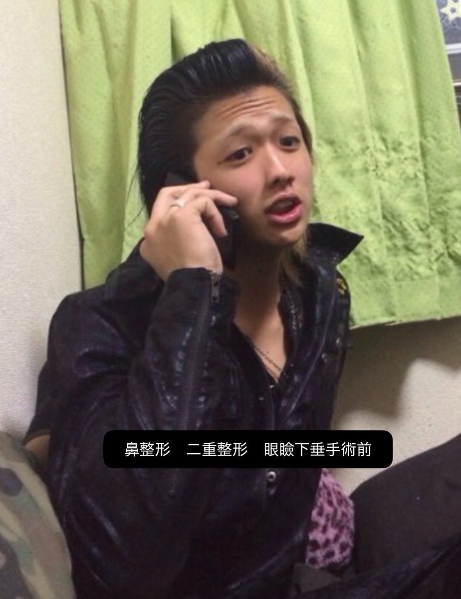 motiva55's tweet photo. ラブ上等、緋咲一馬さんの顔解剖学。

眼瞼下垂手術と二重切開で幅広二重を作り、鼻フル（軟骨移植に隆鼻術はシリコンプロテーゼかな）でEラインを作る。

ドカタフェイスからホストの頂点に垢抜き大優勝！！！！全ドカタ男子に勇気を与えるね。 https://t.co/DtvQ36RSa8
