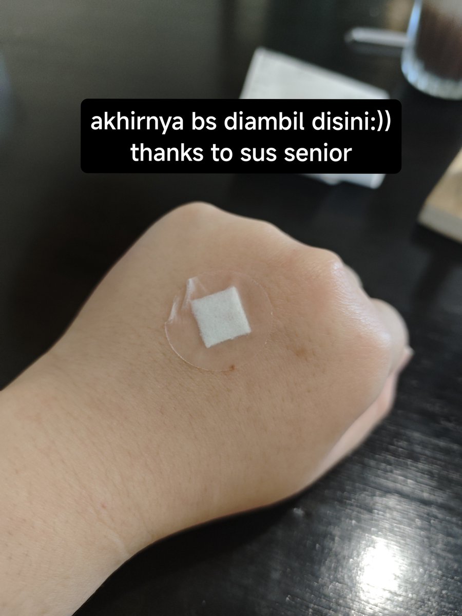 newtpotters's tweet photo. pagi yg sangat hiks hiks hiks 😭😭
daridulu donor darah &amp; MCU gapernah sekalipun sampe ditusuk berkali2" begini 😭😭😭😭😭

dah kl di malang BETTER ke RSSA aja!
rame sih, tapi at least nersnya pro.

untungnya ni lab deket setumpuk jd at least bs menghibur diri :"))) https://t.co/eJDXa3Lhhq