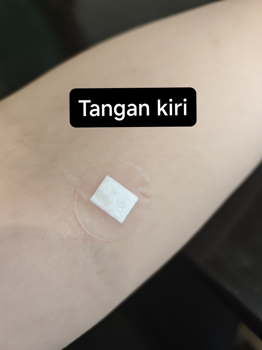 newtpotters's tweet photo. pagi yg sangat hiks hiks hiks 😭😭
daridulu donor darah &amp; MCU gapernah sekalipun sampe ditusuk berkali2" begini 😭😭😭😭😭

dah kl di malang BETTER ke RSSA aja!
rame sih, tapi at least nersnya pro.

untungnya ni lab deket setumpuk jd at least bs menghibur diri :"))) https://t.co/eJDXa3Lhhq