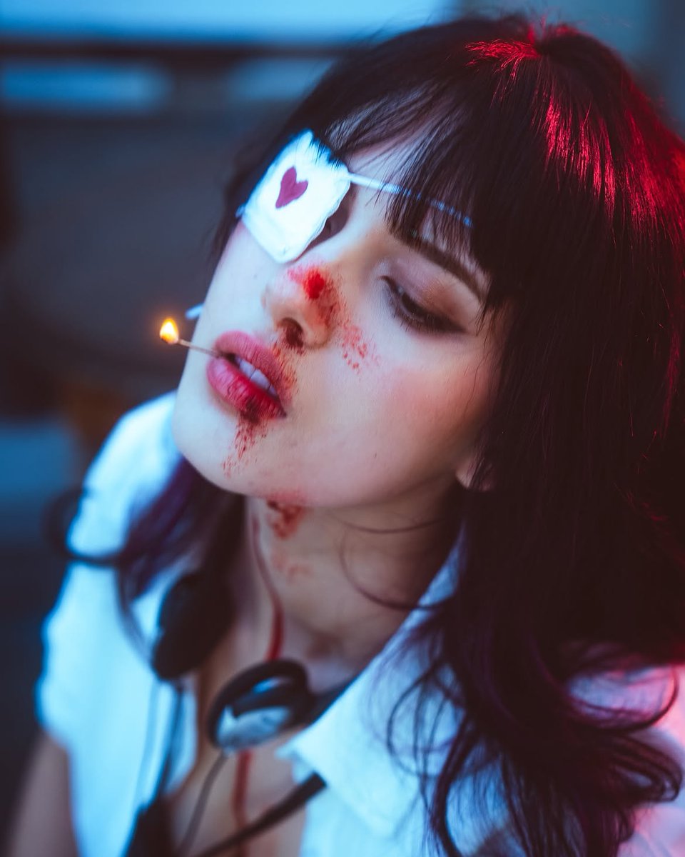 drew02742's tweet photo. You should’ve seen the other guy 😅🤕 https://t.co/XB94hzpgQV