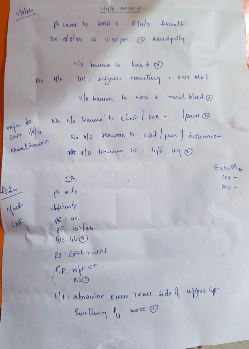 nbramllb's tweet photo. At Marredpally (West) on 10.08.2026 at around 11:30 PM, a young man was assaulted by police personnel. When his relative questioned the action, Inspector T. Srisailam Naik (DI Marredpally) took him into a room and assaulted him in front of constables. He did not even listen to his own colleagues who had previously worked in that jurisdiction and tried to intervene.

The injured person, K. Sai Kiran (28), was first treated at Musheerabad Hospital (MLC No. 99794). Later the same day he was examined by an ENT specialist at Medicover Hospitals. Diagnosis: Nasal Trauma with nasal dorsum swelling and history of epistaxis. Injuries also included abrasion on upper lip, trauma to head and left leg, and pain in abdomen and lower back.

Victim wife pregnant woman pleaded for his release, she was informed no such person brought inside, no information was given about victim. He was let go only after hours and after signing a written note under pressure.

Using physical force on ordinary citizens in front of subordinates is not policing. Superior officers must ensure basic discipline and accountability.

@CyberabadPolice @TelanganaDGP @bandisanjay_bjp @AmitShah