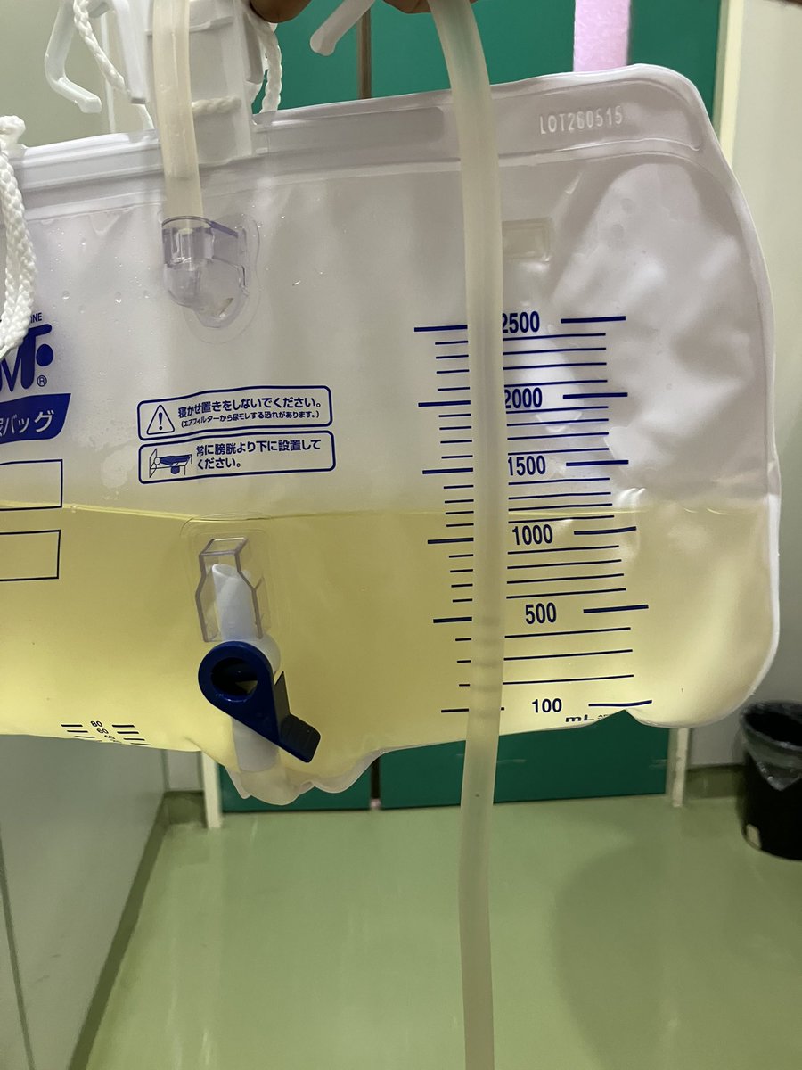 dai_omtu's tweet photo. 今日は大腸カメラ、下剤飲めないから高圧浣腸��、おしっこも出ないからバルーン入れてもらって前も後ろも管だらけ💦 https://t.co/q3i8KmOlQu