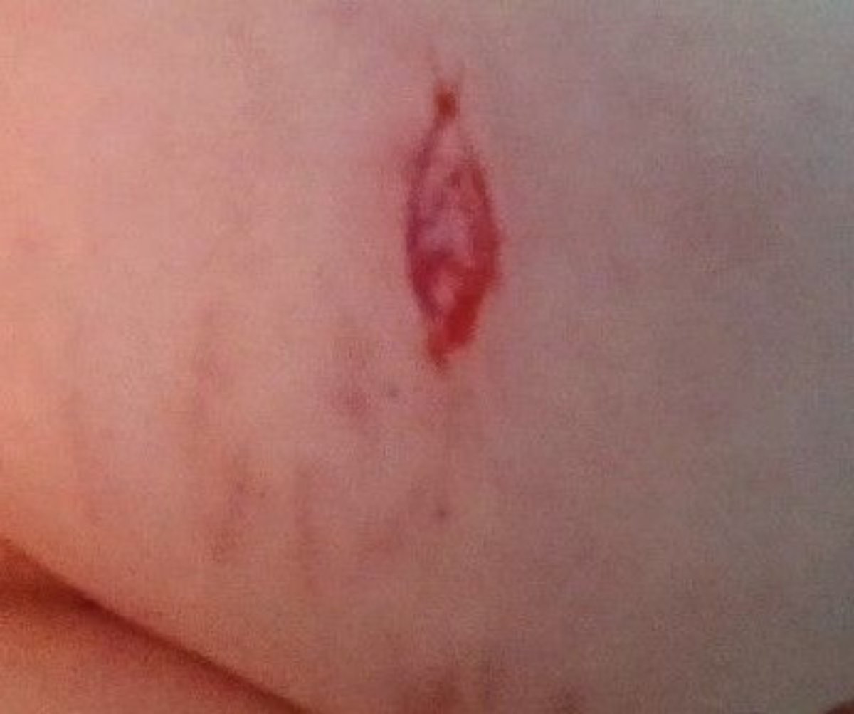 cutmedeceased's tweet photo. MAKEUP FAKE NOT REAL for early Halloween!! 
Does anyone know what layer this is? It bled for thirty minutes 😿 also sorry the photos are bad !! #shedtwt #shtwt #slittwt https://t.co/pFAmjqp7m3