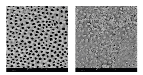 YeHzkl99's tweet photo. Teeth before and after consistent use of nano hydroxyapatite toothpaste https://t.co/de9RiY3228