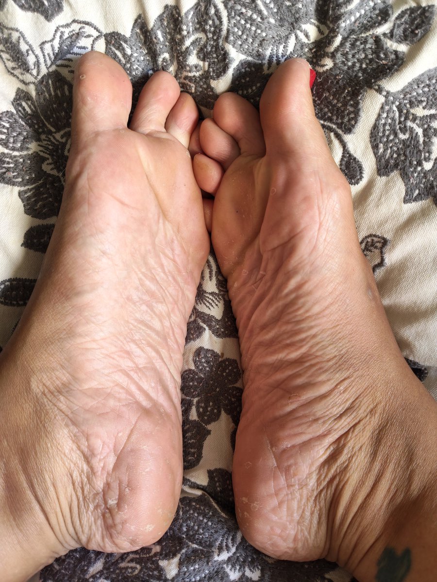 Mundo22_'s tweet photo. @rt_feet Are you ready for a closer look? 👀 https://t.co/Fn1PIeanHL