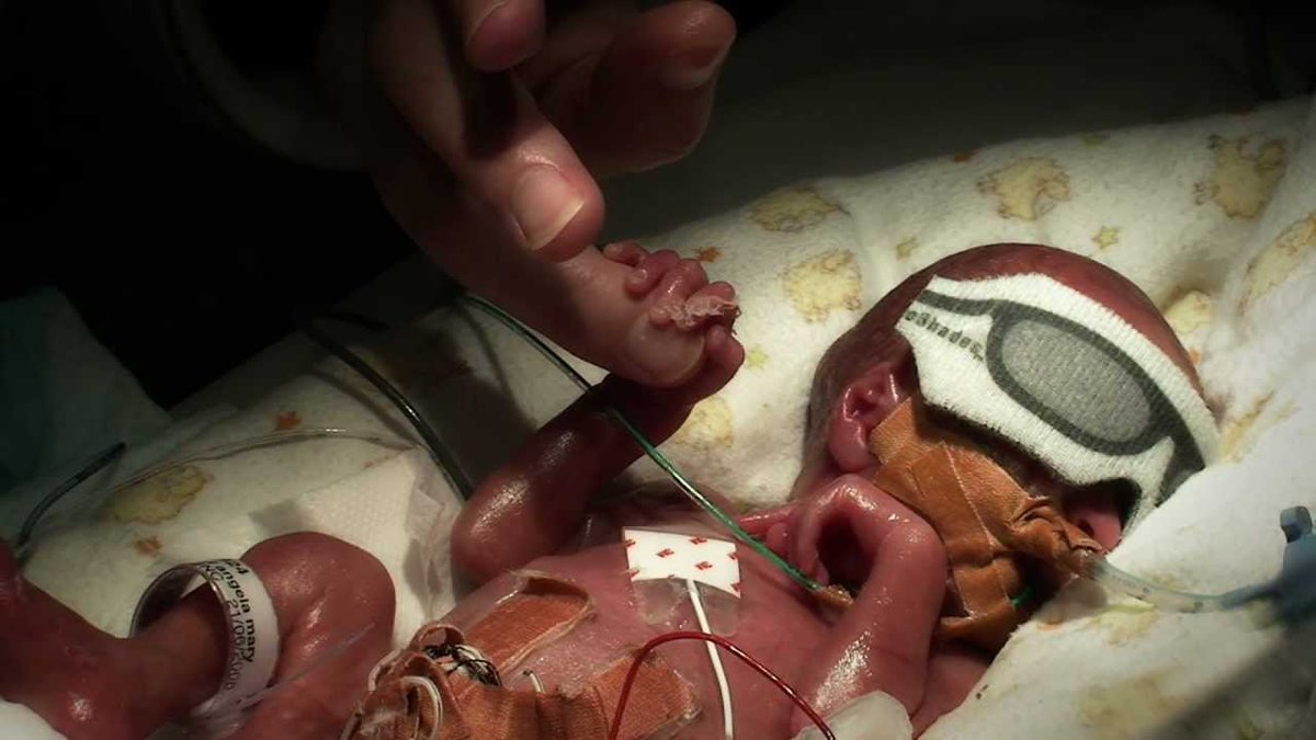 nmakuden's tweet photo. Here's a 24 week old fetus outside the womb. In India, abortion up to this point is permissible under the MTP Act.

It's sickening to think that encouragement towards ending the killing of these innocent human lives is considered as religious propaganda.

#StandwithJCDPrabhakar https://t.co/nnRjY6oPv3