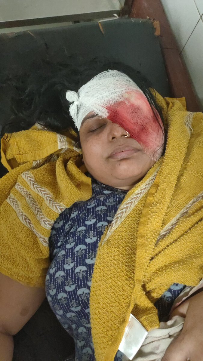 Prashan74927378's tweet photo. क्या गजब कार्यशैली है @kanpurnagarpol की पीड़ित की आंख चली गई चौकी चकेरी इंचार्ज प्रदीप भाटी जांच के नाम का दे रहे पीड़ित को चूर्ण।
पीड़ित महिला लगा रही थाना चकेरी एवं चौकी चकेरी के चक्कर पर नहीं लिखी जा रही FIR  @Uppolice @dgpup @igrangekanpur @adgzonekanpur @myogiadityanath https://t.co/CvAUBefvjx