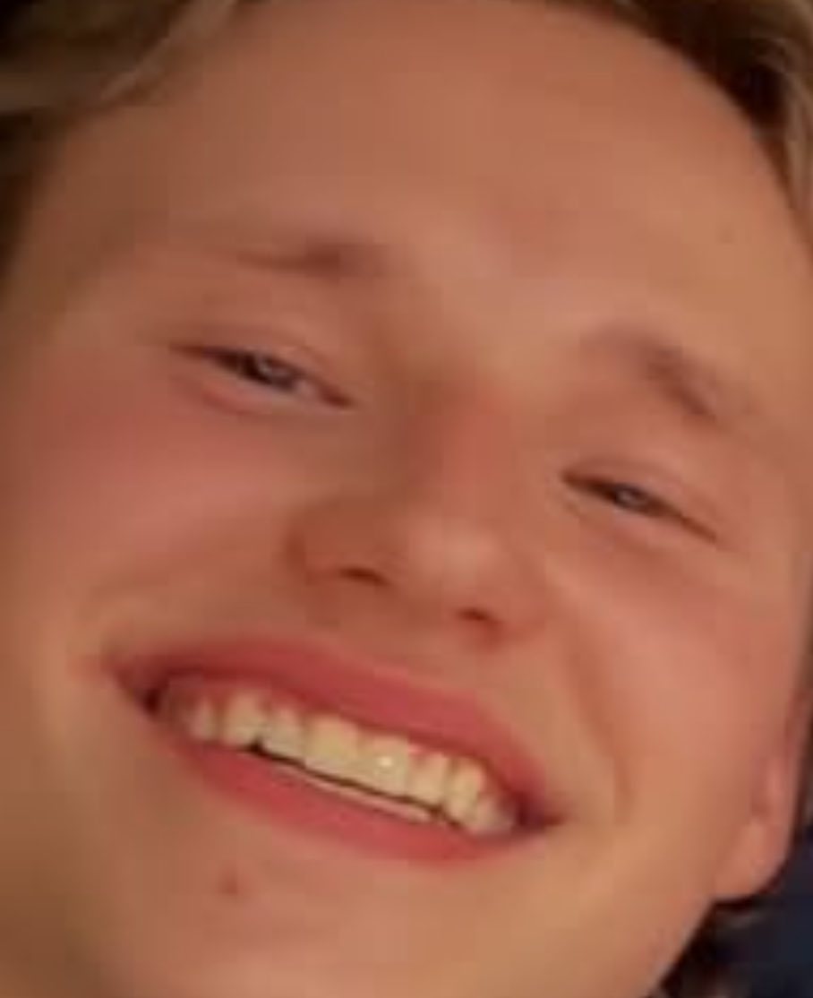 xottqpn's tweet photo. down syndrome https://t.co/i0VxKUhEe5