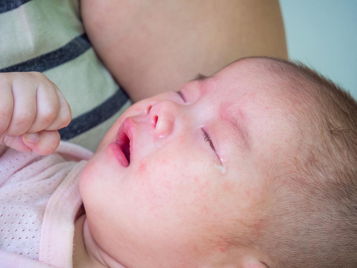 CIDRAP's tweet photo. Nirsevimab linked to reduction in RSV-related antibiotic prescribing

Researchers say the results suggest the monoclonal antibody could be a tool for antibiotic stewardship.

Read more: https://t.co/yq4stJFl3Y https://t.co/0SEfoazLEK
