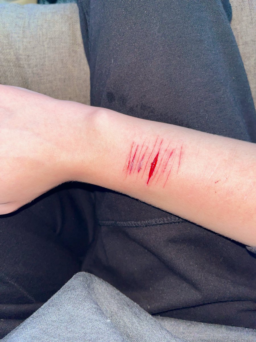 digitxlpawpr1nt's tweet photo. accident while doing sfx makeup, fake body fake skin and fake blood, not real, stunt.
tw
#shrtwt #shedrtwt #slittwt #sledtwt #oneswipe https://t.co/bJmD9Z7KBN