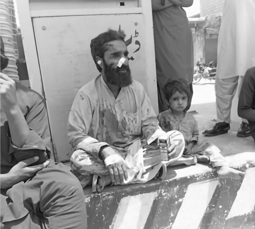 Jam__Baloch's tweet photo. Injured family members of those killed in Pakistan army bombing today in Gadar Gondan, Soorab, have placed the dead bodies of their loved ones at Soorab Main Chowk and are on a set-in protest. Even the injured children are there. Be their voice! Support them! #StopBalochGenocide https://t.co/kw7EPXhf3S