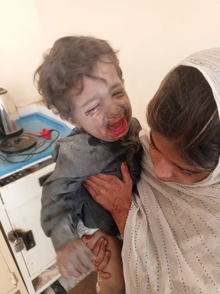 BYCKarachi's tweet photo. سوراب، گدر میں عام آبادی پر ہونے والی بمباری بلوچ قومی یادداشت میں ہمیشہ کے لیے ایک گہرے زخم کے طور پر محفوظ رہے گی۔

یہ صرف ایک سانحہ نہیں، بلکہ ان ماؤں کی اجڑی گودیں، ان بچوں کے چھینے گئے خواب اور ان خاندانوں کی تباہی ہے جو اپنے ہی گھروں میں محفوظ نہ رہ سکے۔
1/2 https://t.co/NWsv03HGAw