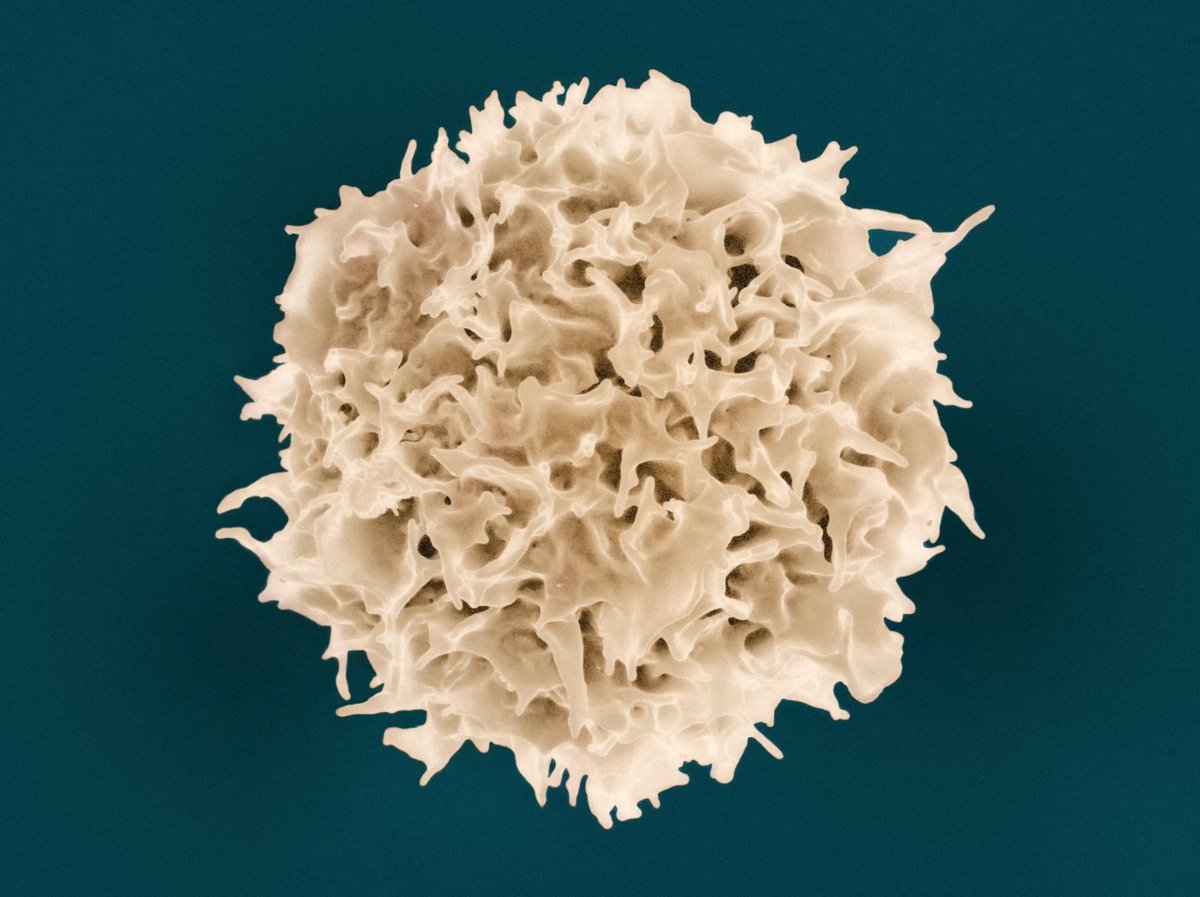 celltherapynews's tweet photo. Dr. Hongping Yin and collaborators are working to improve #CART efficacy in solid tumors.
They used S71 promoted enhanced persistence and robust #ImmuneMemory responses.
Check out the work in @CIR_AACR: https://t.co/BCXtdRuRtL https://t.co/EXbkPUqePS