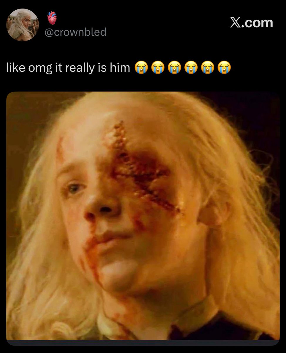 crownbled's tweet photo. oh word? https://t.co/6MXFYnVCub
