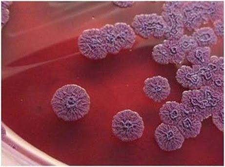 biovaxys's tweet photo. Burkholderia pseudomallei is a bacterium that causes melioidosis, a serious and potentially fatal infectious disease classified by the CDC as a bioterrorism agent due to its potential for aerosol dissemination, severe clinical impact, and resistance to many antibiotics.
A DPX formulated burkholderia vaccine protected 100% of mice following live bacterial challenge. Mice were administered either two doses of a DPX formulation or three doses of an aqueous Burkolderia vaccine. Mice were subsequently challenged with B. pseudomallei, with a 100% survival rate achieved following vaccination with the DPX candidate.
BIOV is getting together tomorrow with a research group at the University of Florida Emeging Pathogens Institute that has been engaged in UK government & DTRA-funded work on burkholderia vaccines and has expressed interest in DPX formulations.