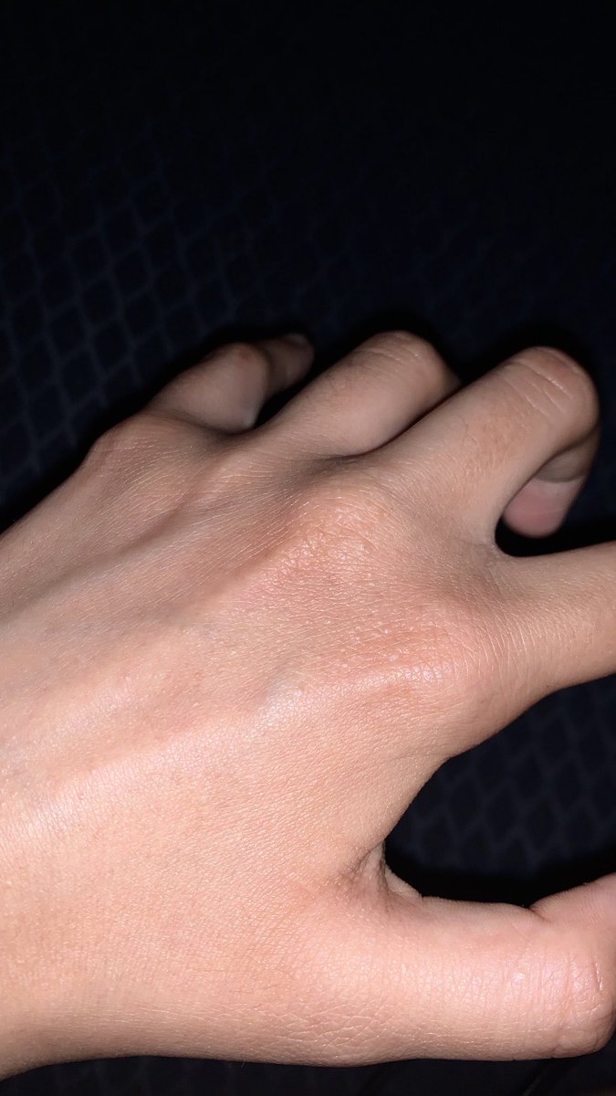 zombbvv's tweet photo. what are those dots https://t.co/tfgmddmLZh