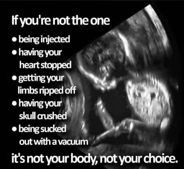 Sassafrass_84's tweet photo. All baby lives matter. https://t.co/U7EoNSO983