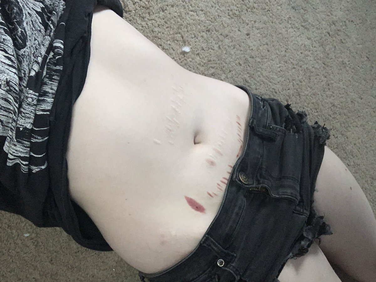 d0gb0nezz's tweet photo. i might be my own comparisonspo
(***FAKE!! FOR EDUCATIONAL PURPOSE!!!***)
#editwt #edrtwt #bc #ricecaketwt #hungertwt https://t.co/Be3pLWca5X