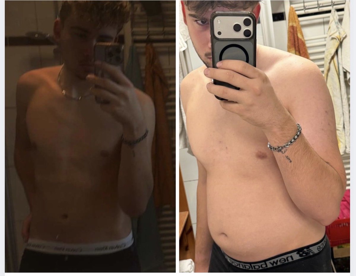 goodboybulk's tweet photo. January → now

70 kg (154 lbs) → 90 kg (198 lbs)

20 kg heavier than I was in January. Looking back at these pictures, it’s honestly kinda crazy how much I’ve changed. I’ve gotten softer, bigger and definitely fatter — and I’m nowhere near done. https://t.co/lvv7sQvpgk