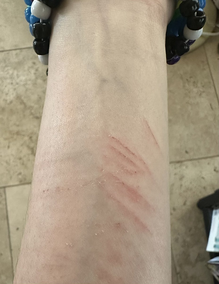 MNTALLYILLKID's tweet photo. How it is now
#shtwt #catscratches https://t.co/fxWeLrzvYM
